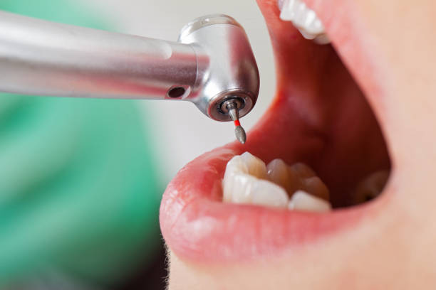 Best Tooth Infection Emergency Dentist  in Shark River Hills, NJ